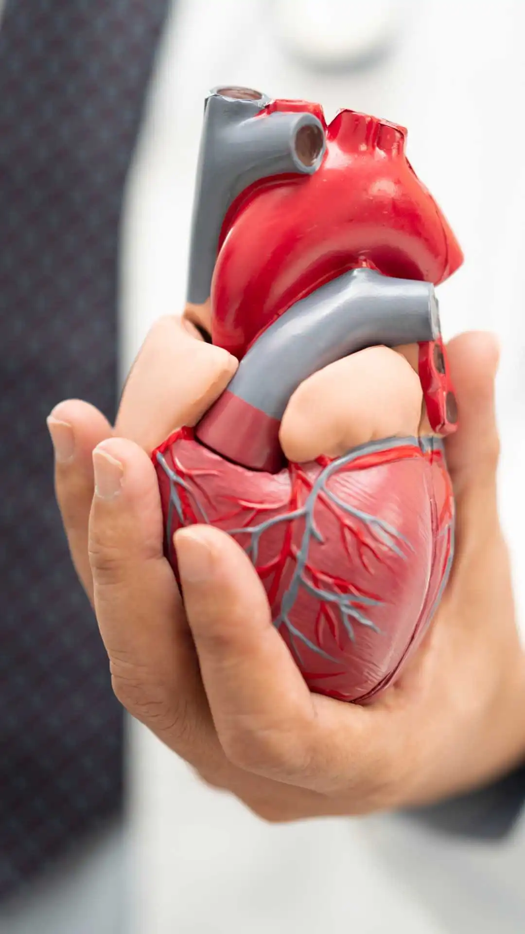perfil lipidico glicemia hipertension cardiovascular bysaa ibague