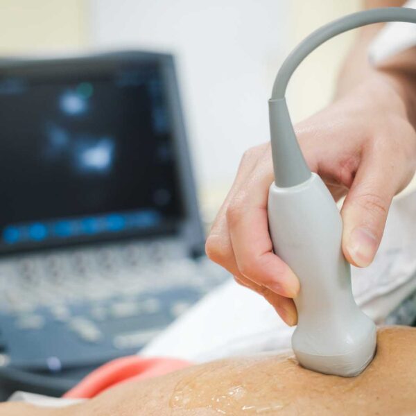 Ecocardiograma